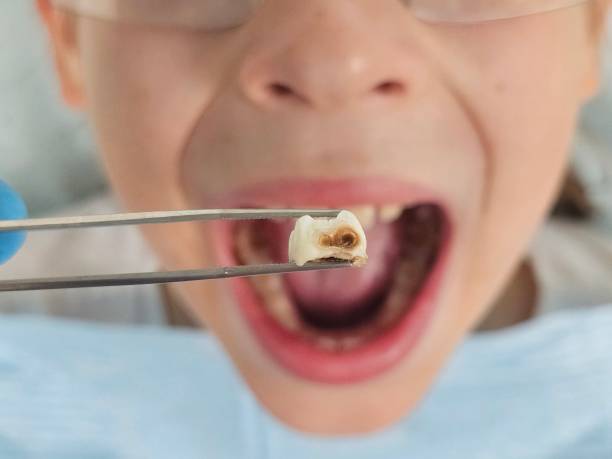 Best Weekend Emergency Dentist in Berryville, VA